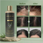 Kerarose Rosemary Shampoo For Hair Growth (Buy 1 Get 1 Free)