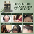 Kerarose Rosemary Shampoo For Hair Growth (Buy 1 Get 1 Free)