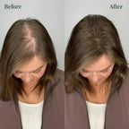 Kerarose Rosemary Shampoo For Hair Growth (Buy 1 Get 1 Free)