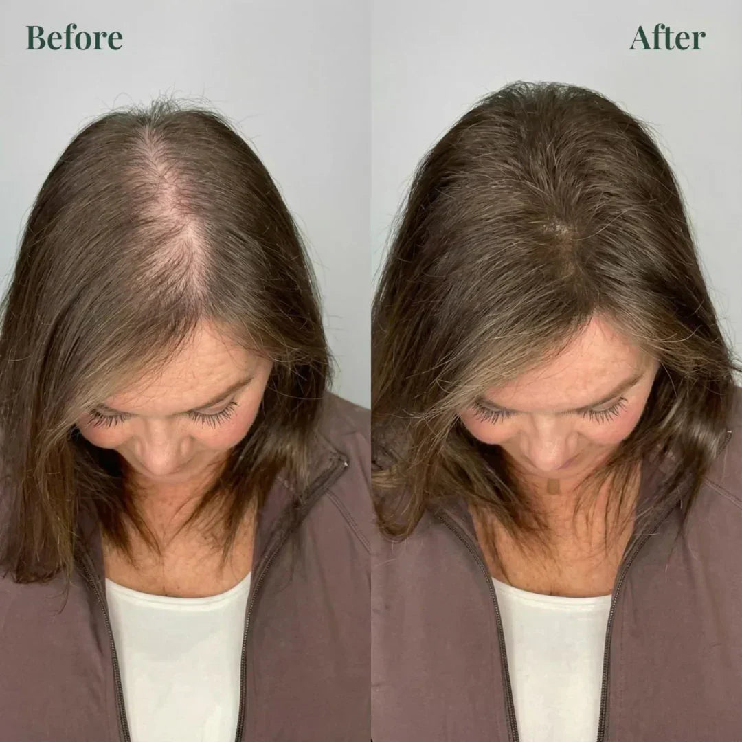 Kerarose Rosemary Shampoo For Hair Growth (Buy 1 Get 1 Free)