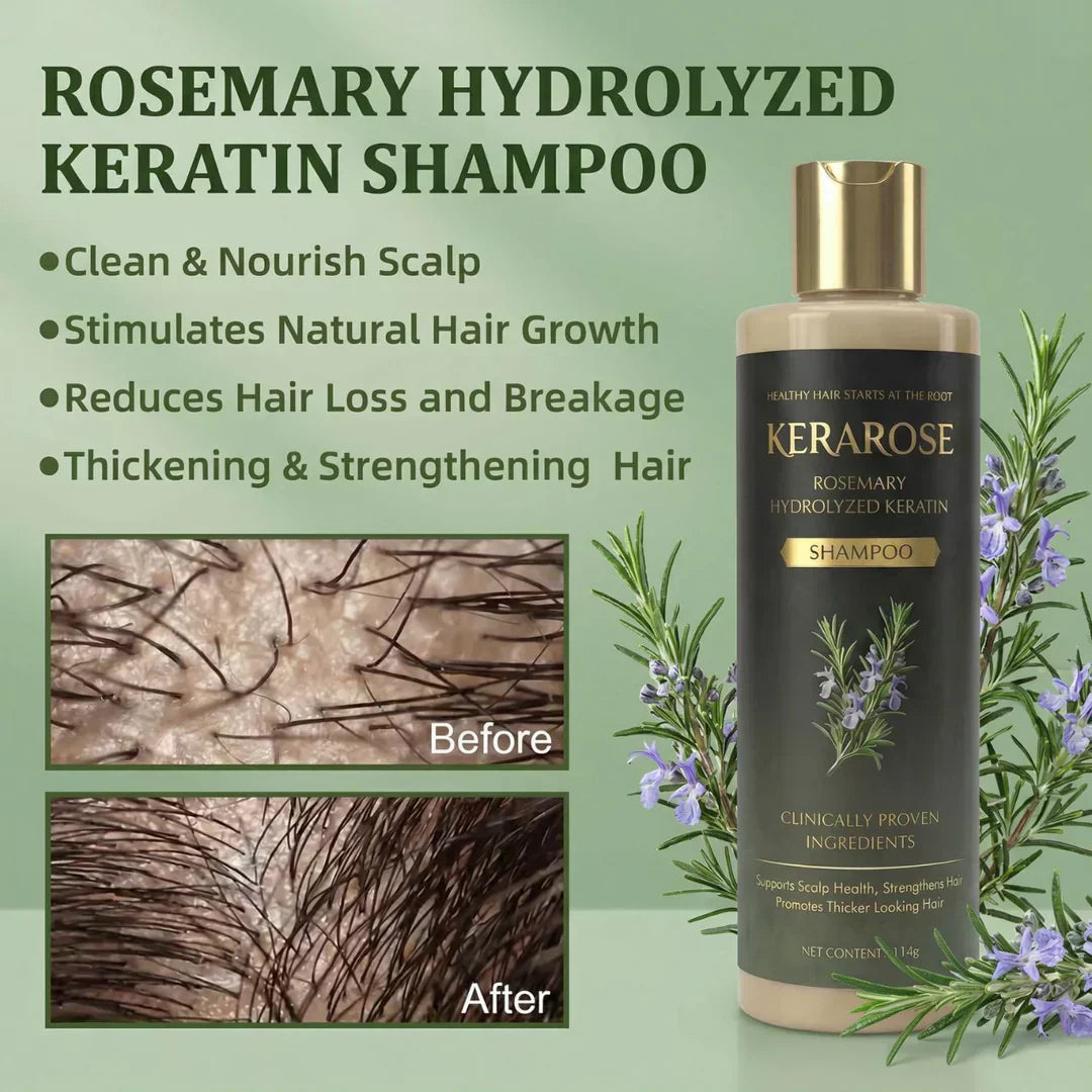 Kerarose Rosemary Shampoo For Hair Growth (Buy 1 Get 1 Free)
